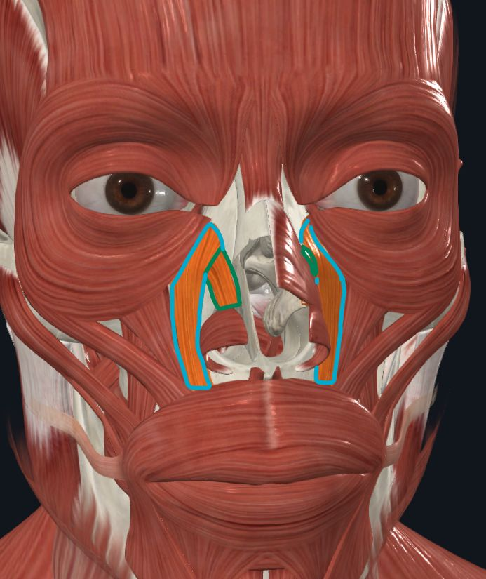 <p><strong>Nombre alterno: X</strong></p><p><strong><mark data-color="yellow" style="background-color: yellow; color: inherit">Orígen:</mark></strong></p><p><mark data-color="yellow" style="background-color: yellow; color: inherit">Lateral y medial: Apófisis ascendente del maxilar superior</mark></p><p><strong><mark data-color="blue" style="background-color: blue; color: inherit">Inserción:</mark></strong><mark data-color="blue" style="background-color: blue; color: inherit">Fibra&nbsp;<u>medial</u>&nbsp;en ala de la nariz<br>Fibra&nbsp;<u>lateral</u>&nbsp;en labio superior</mark></p><p><strong><mark data-color="red" style="background-color: red; color: inherit">Acción:</mark></strong></p><p><mark data-color="red" style="background-color: red; color: inherit">Eleva nariz y labio superior (Como perro enojado, muestra incisivos y caninos)<br><u>Medial -> Nariz<br>Lateral -> labio superior</u></mark></p><p><strong><mark data-color="purple" style="background-color: purple; color: inherit">Inervación: </mark></strong><mark data-color="purple" style="background-color: purple; color: inherit">Nervio&nbsp;Facial</mark><strong><br><mark data-color="green" style="background-color: green; color: inherit">Relaciones: X</mark></strong></p><p><strong>Notas: </strong>1 medial, 1 lateral</p>