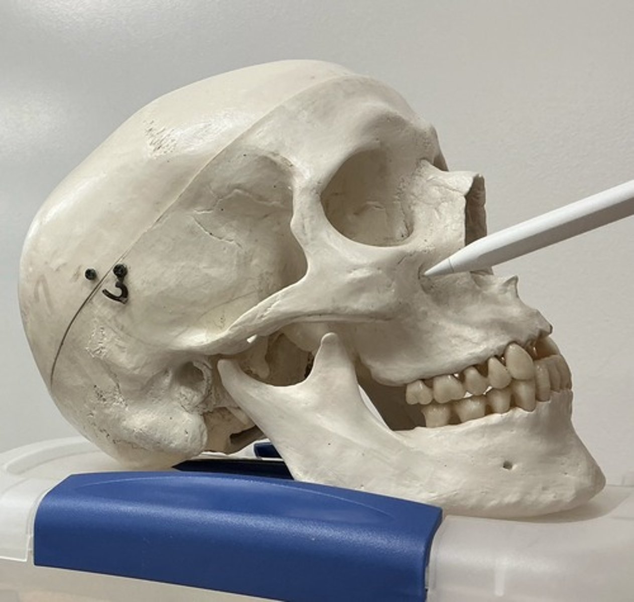 <p>What is the arrow pointing at?</p>