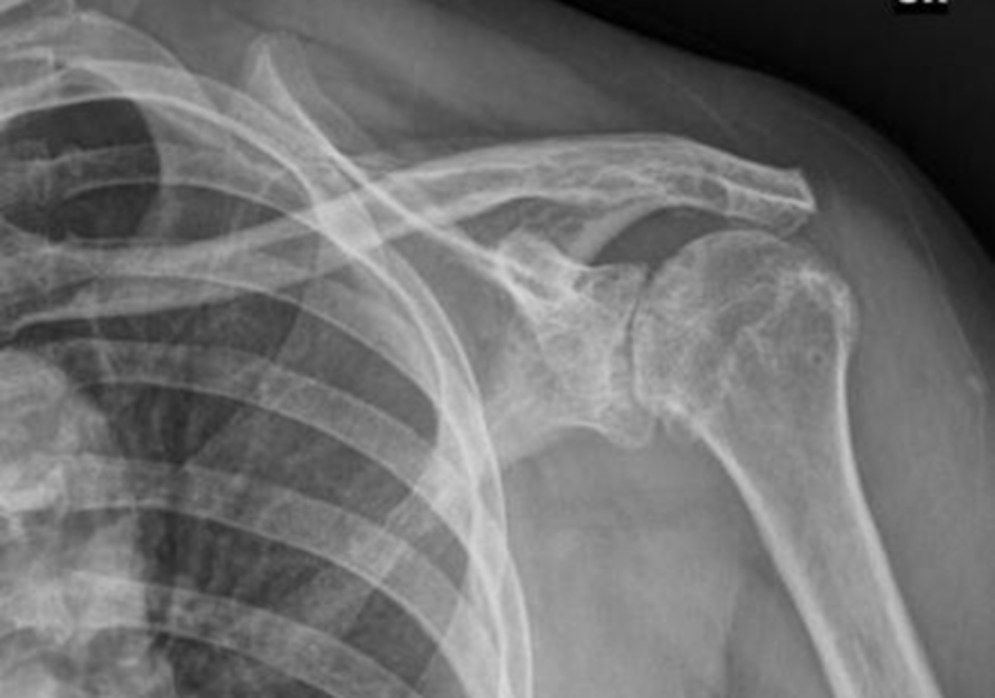 <p>What is this image depicting? Why does it matter?</p>