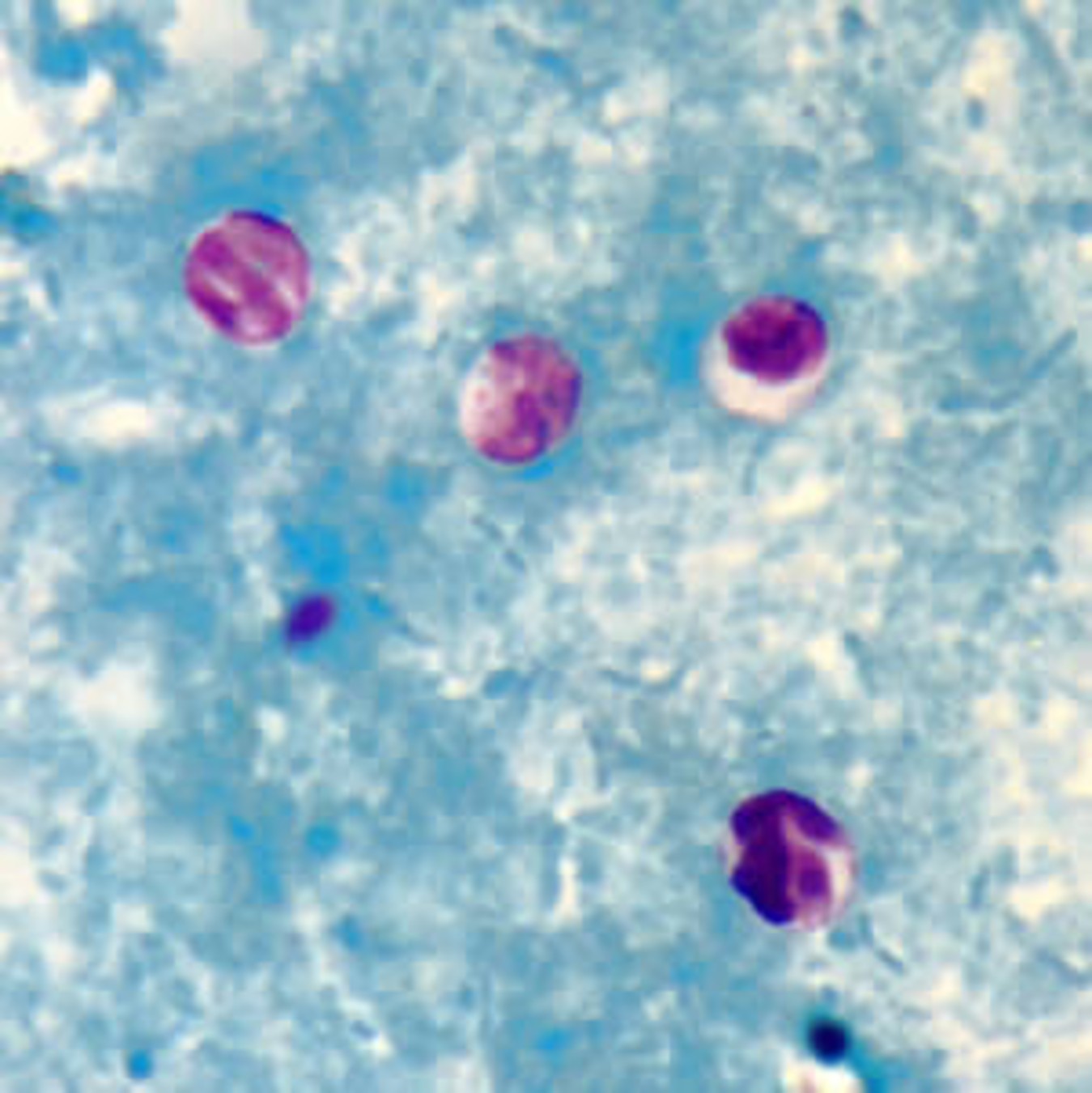 <p><strong>Cryptosporidium spp.</strong></p>