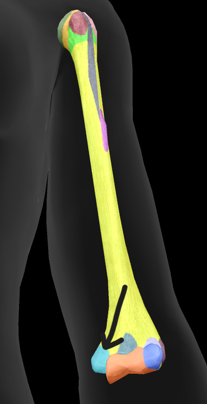 term image