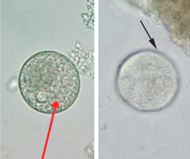 <ul><li><p style="text-align: justify;"><span style="background-color: transparent;"><span>Identify the organism. Give genus and species.</span></span></p><ul><li><p style="text-align: justify;">(1)</p></li></ul></li><li><p style="text-align: justify;"><span style="background-color: transparent;"><span>What is the morphologic stage of the organism?</span></span></p><ul><li><p style="text-align: justify;">(2)</p></li></ul></li><li><p style="text-align: justify;"><span style="background-color: transparent;"><span>What are the structures pointed by the black arrow?</span></span></p><ul><li><p style="text-align: justify;">(3)</p></li></ul></li><li><p style="text-align: justify;"><span style="background-color: transparent;"><span>What is the structure pointed by the red arrow?</span></span></p><ul><li><p style="text-align: justify;">(4)</p></li></ul></li></ul><p></p>