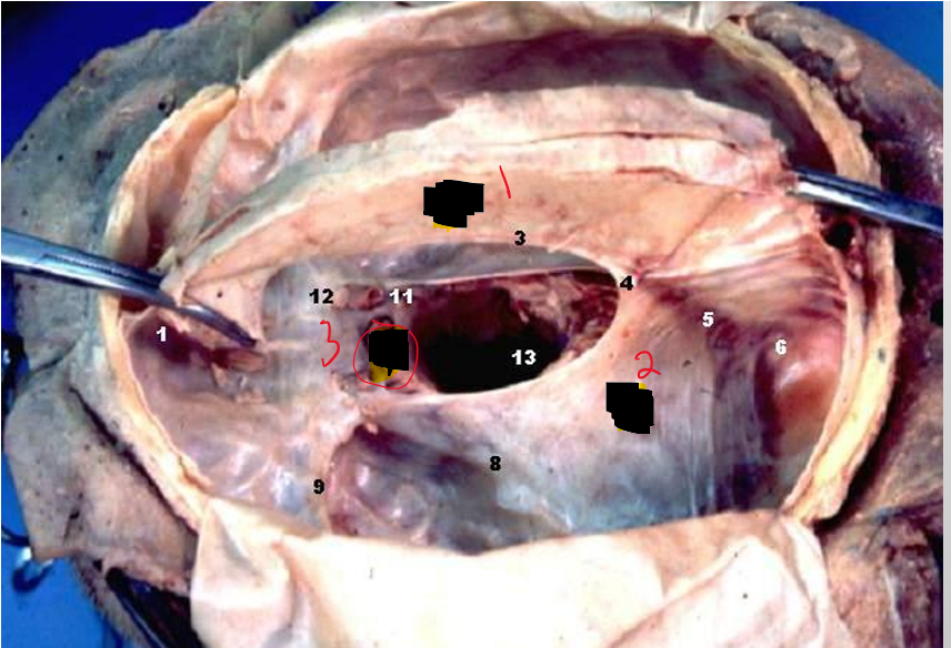 <p>Name the Structure.</p>