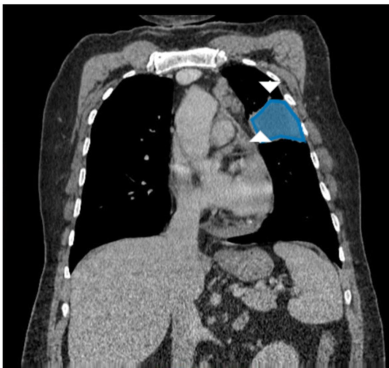 <p>Label pathology in image below</p>