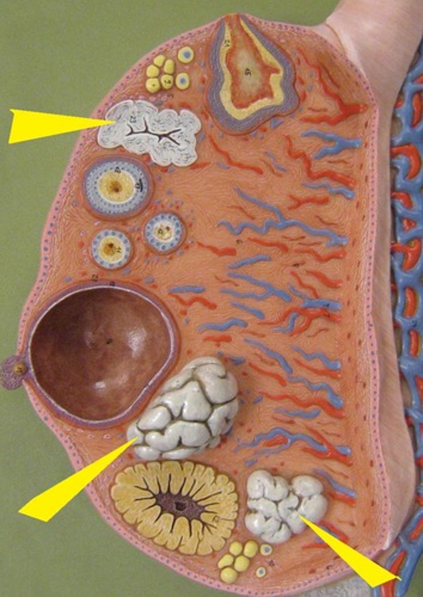 <p>degenerated corpus luteum</p>