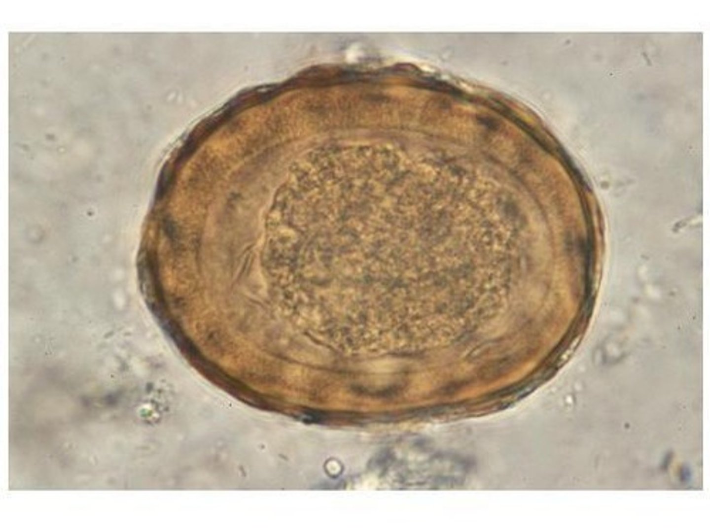 <p>• Egg</p><p>o Rough, bumpy surface</p><p>o Thick shell, stained with</p><p>bile</p>