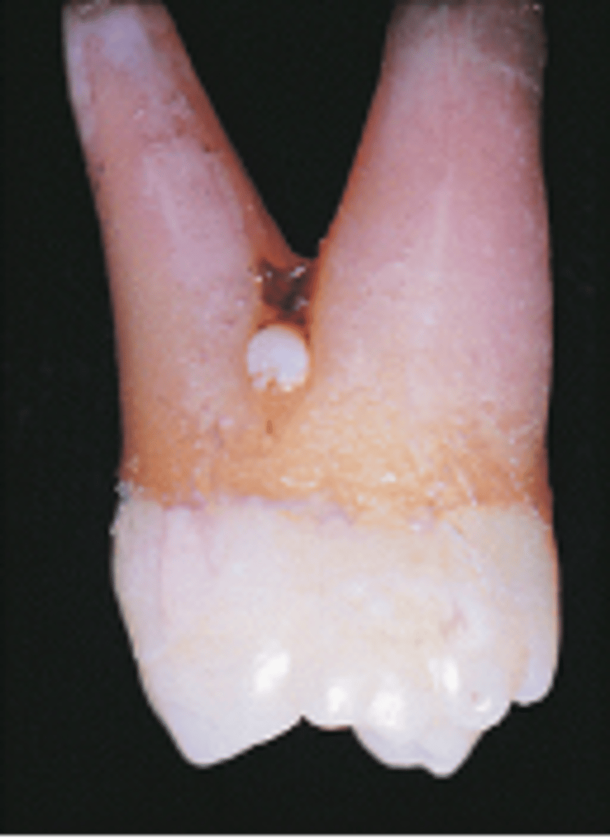 <p>Enamel Pearl</p>