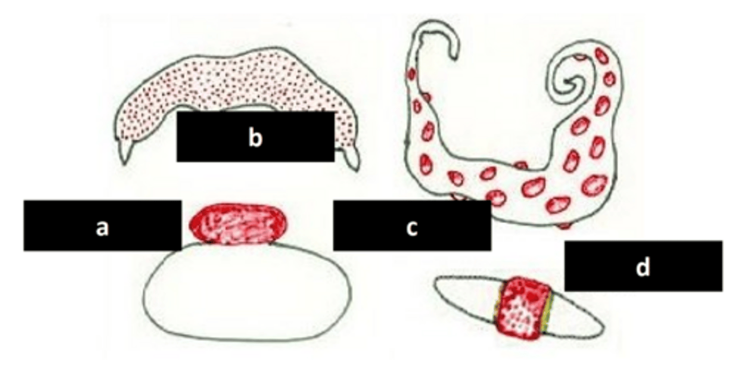 <p>c: placenta type, species example</p>