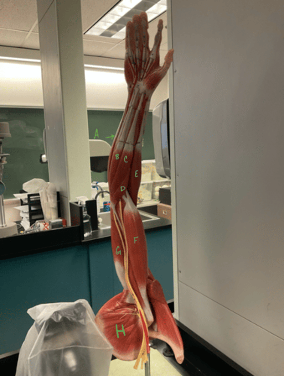 <p>pronator teres</p>