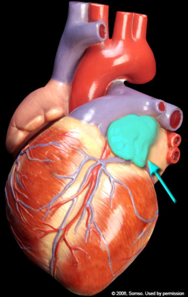 <p>What part of the heart is this?</p>