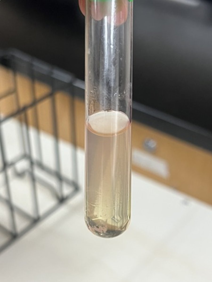 <p>Tests for organisms ability to produce gelatinase to hydrolyze gelatin.</p><p>Negative test- Solid medium</p>