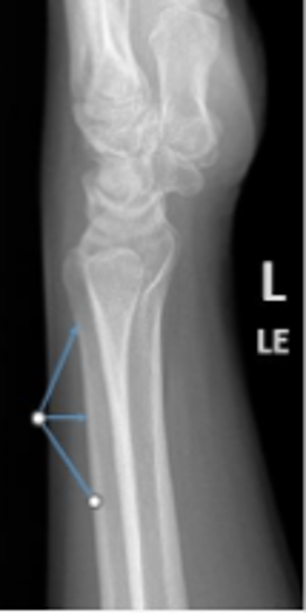 <p>What is the arrow pointing to?</p>