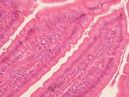 <p>Simple columnar epithelium</p>