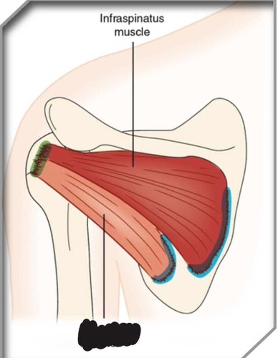 <p>What muscle is this?</p>