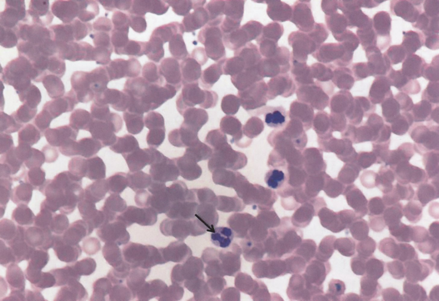 <p>C. Neutrophilic granulocyte</p>