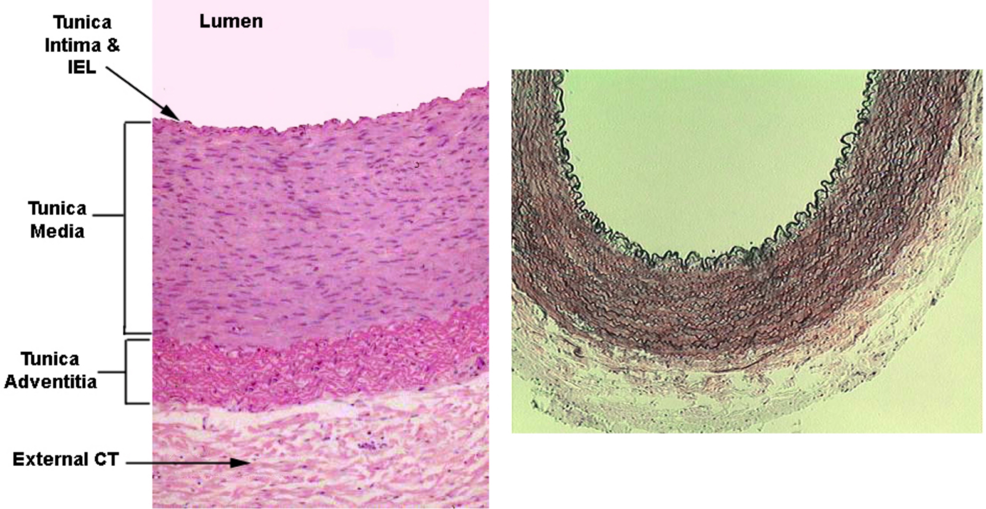 <ul><li><p>Thick smooth muscle layer (tunica media) (very solid structure): Acts as pressure reservoir</p></li><li><p>Have thick connective layer (tunica adventitia)</p></li><li><p>Endothelial layer</p></li><li><p>Large lumen</p></li></ul><p>→ Take all pressures from systole, need to absorb pressure, need to stretch or pressure would spread to capillaries and they would burst. Expand during contraction and squeeze blood around body when heart is at rest.</p>