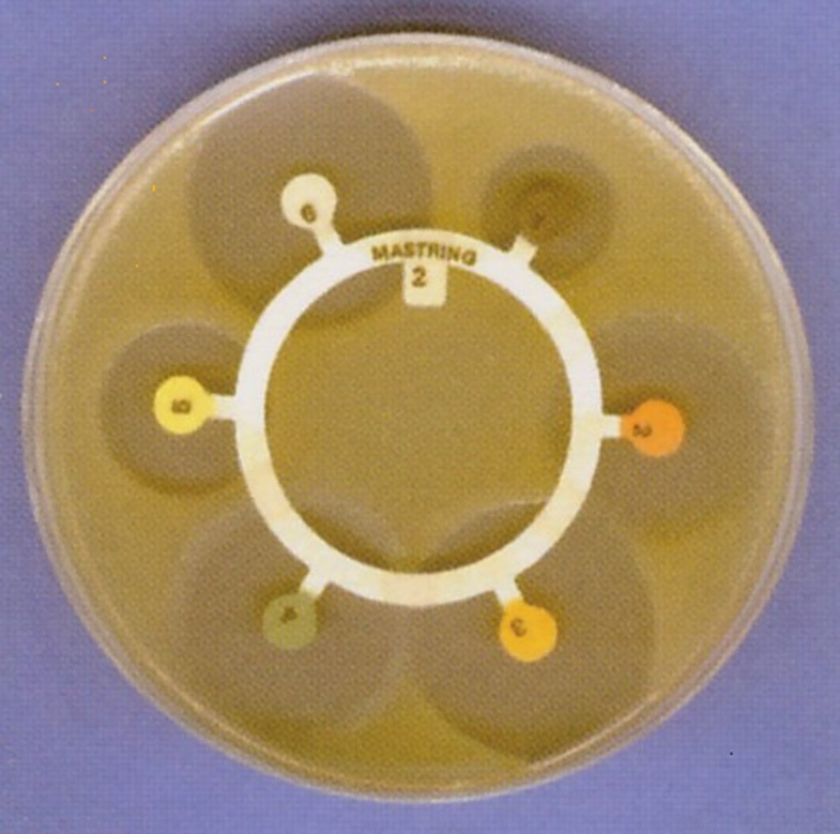 <p>Equipment</p><p>•Petri dish, agar seeded with E.coli</p><p>•Sterile forceps &amp; paper discs</p><p>•Marker pen</p><p>•Mast ring with at least 5 different antibiotics</p><p>•Ruler</p><p>Method</p><p>1) Place the mast ring with antibiotics on the petri dish.</p><p>2) Close dish, seal with tape but leave a gap to allow for aerobic conditions</p><p>3) Leave cultures to incubate at 25°C for a day.</p><p>4) Use ruler to measure the radius of the clear zone of inhibition circle for each antibiotic disc.</p><p>Control</p><p>The control can be a plain paper disc with distilled water, to compare results with</p><p>Calculation</p><p>Area of zone of inhibition =πr² , r being measured by ruler.</p><p>Means can be calculated from repeats.</p><p>Conclusion</p><p>Disc with biggest Z.of Inhib= most effective antibiotic</p>