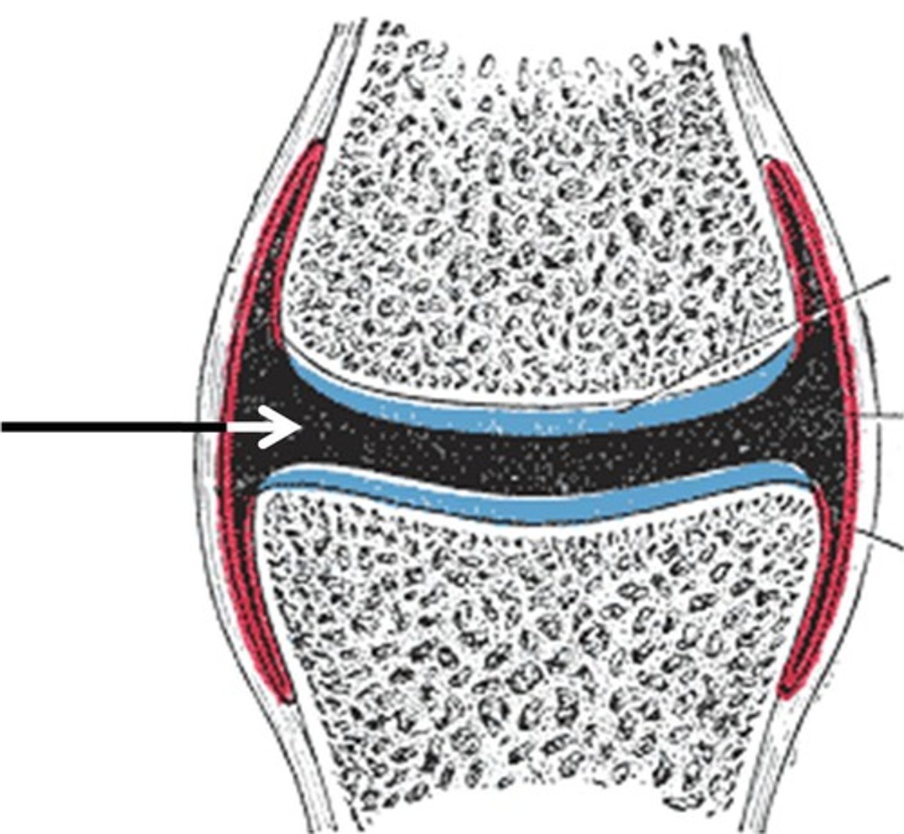 <p>This is filled with synovial fluid which prevents bones rubbing against each other</p>