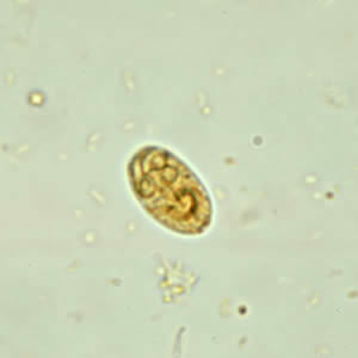 <p>cyst</p>