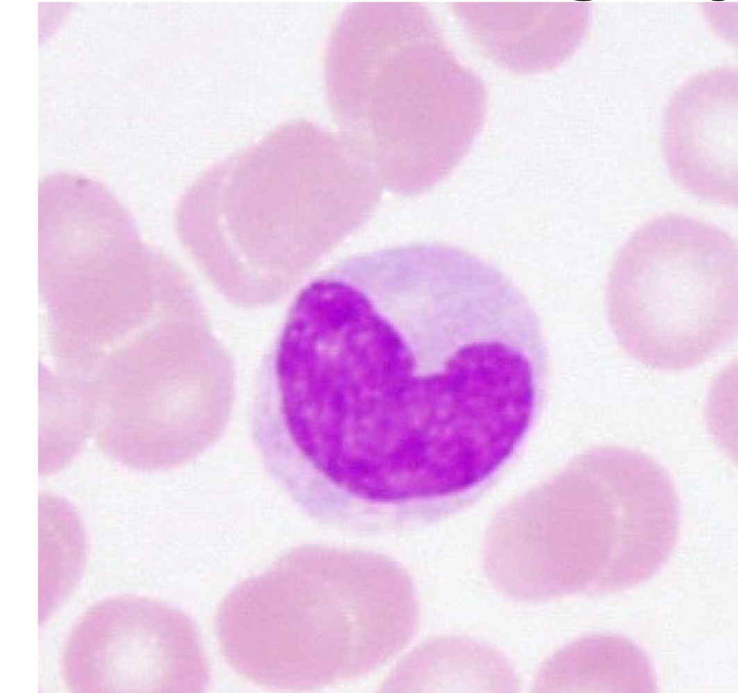 <p>Monocytes</p>