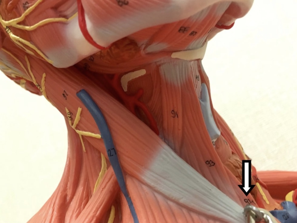 <p><span>Name the muscle labeled with the white arrow below:</span></p>