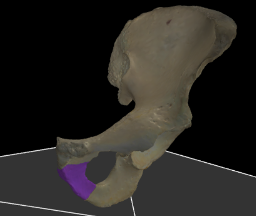 <p>De onderste beenbalk van het os pubis, eveneens onderdeel van de structuur rond het foramen obturatum.</p>