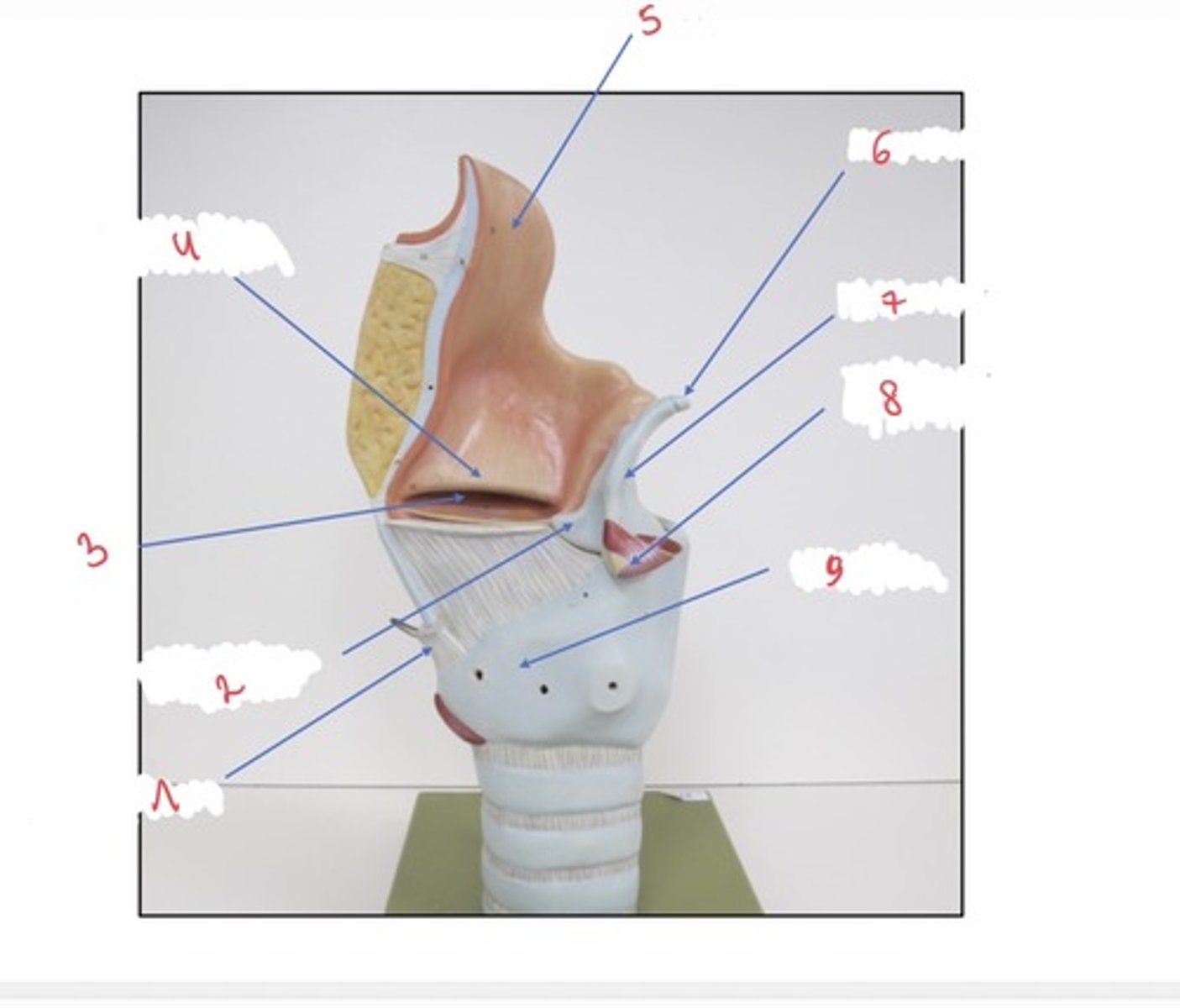 <p>wat wordt er aangeduid met 7</p>