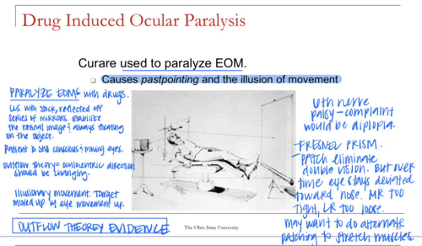<p>Drug Induced Ocular Paralysis is an example of (inflow/outflow) theory</p>