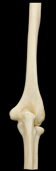 <p>What are the three bones seen here?</p><p>Left side or right side?</p><p>(Posterior view).</p>