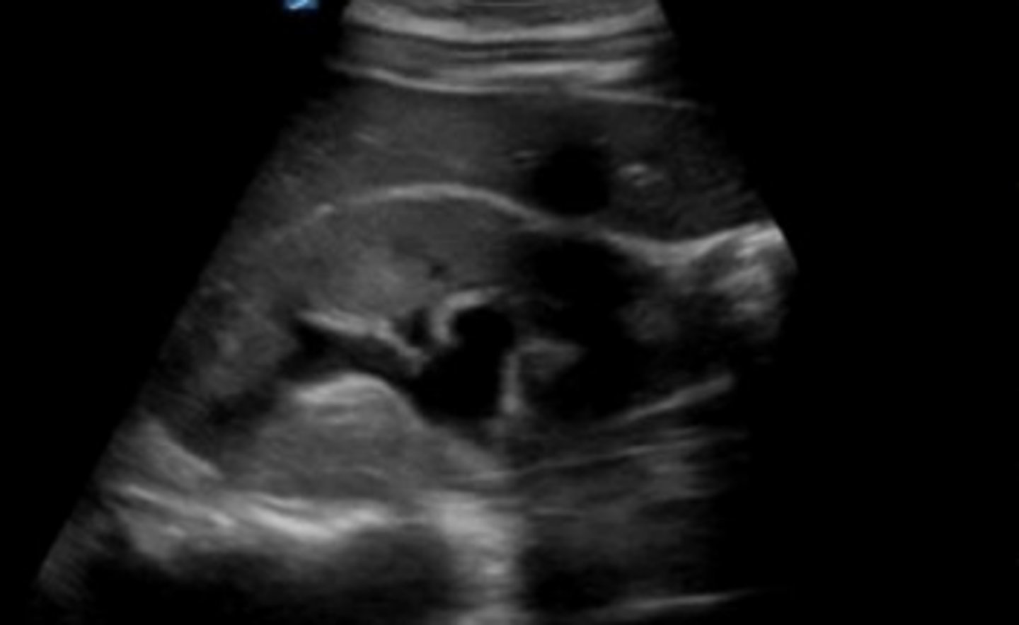 <p>What is seen here?</p>