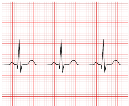 <p>what is the heartrate (round up) (20 small squares)</p>