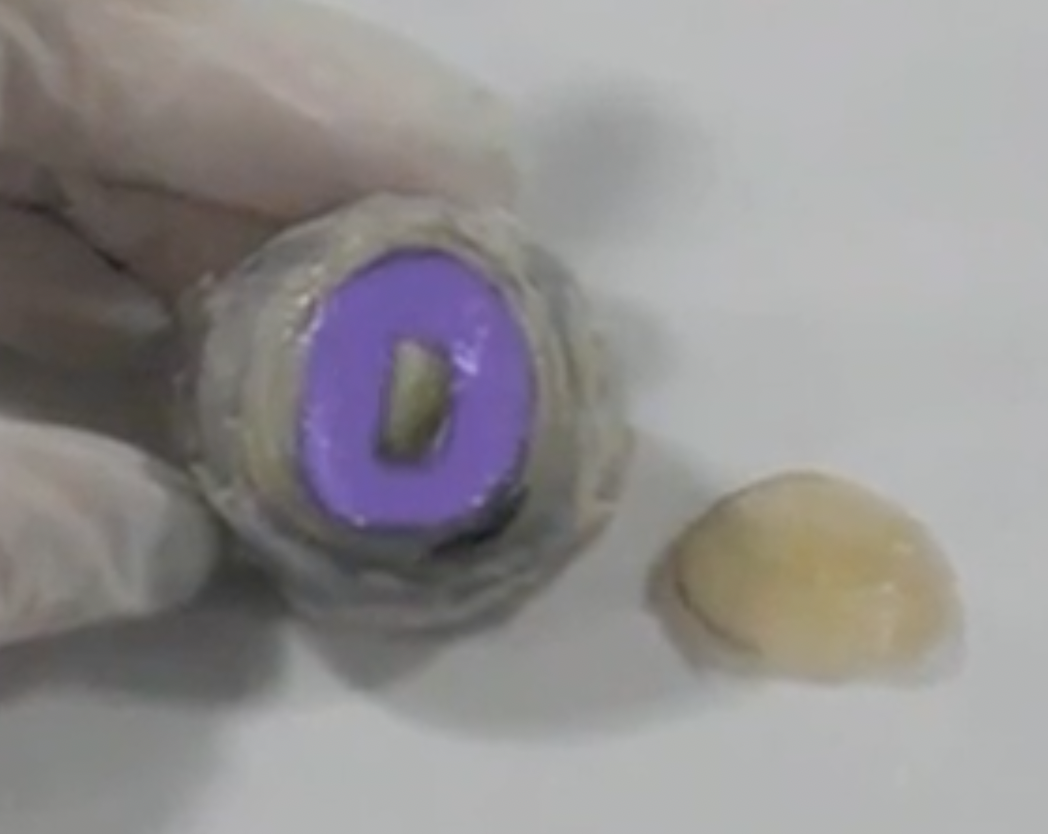 <p>colored part of the eye, muscular structure that controls the size of the pupil</p>