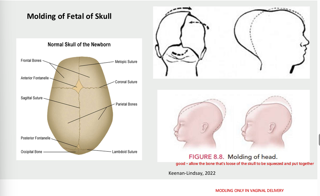 <ul><li><p>only in vaginal delivery&nbsp;</p></li></ul><p></p>