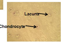 <p>structure: scattering of chondrocytes among a dense network of visible collagenous fibers</p><p>function: can absorb large amounts of compressive force, found in areas under great stress</p><p>location: pubic symphysis, intervertebral disks, discs of the knee and jaw joint</p>