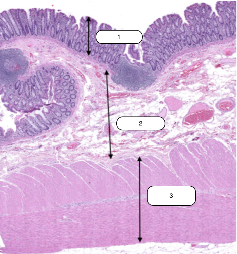 <p>Identify the structure labeled #3</p>
