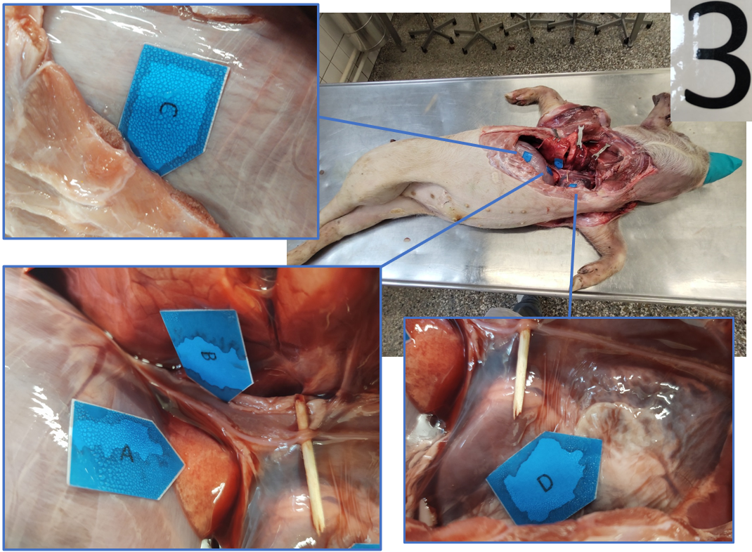 <p>Recessus costodiaphragmaticus</p>