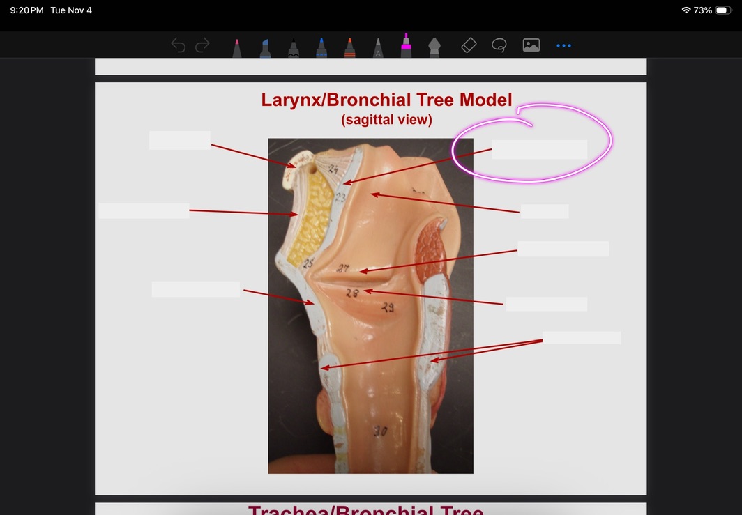 <p>What is this?</p>