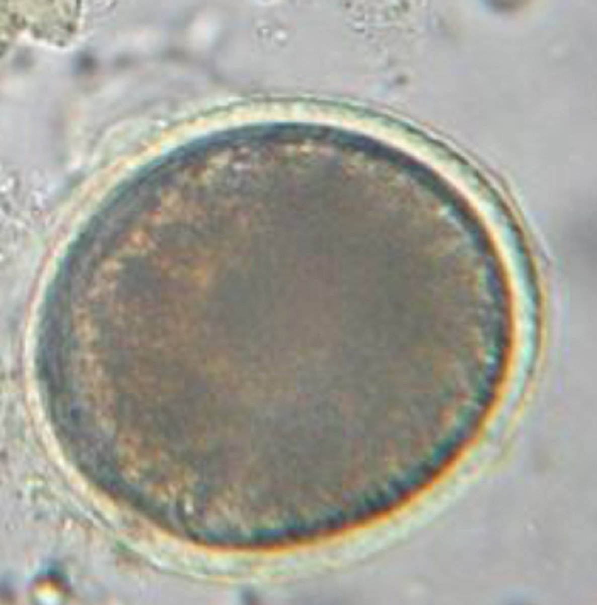 <p>What type of worm in scientific name is presented?</p>