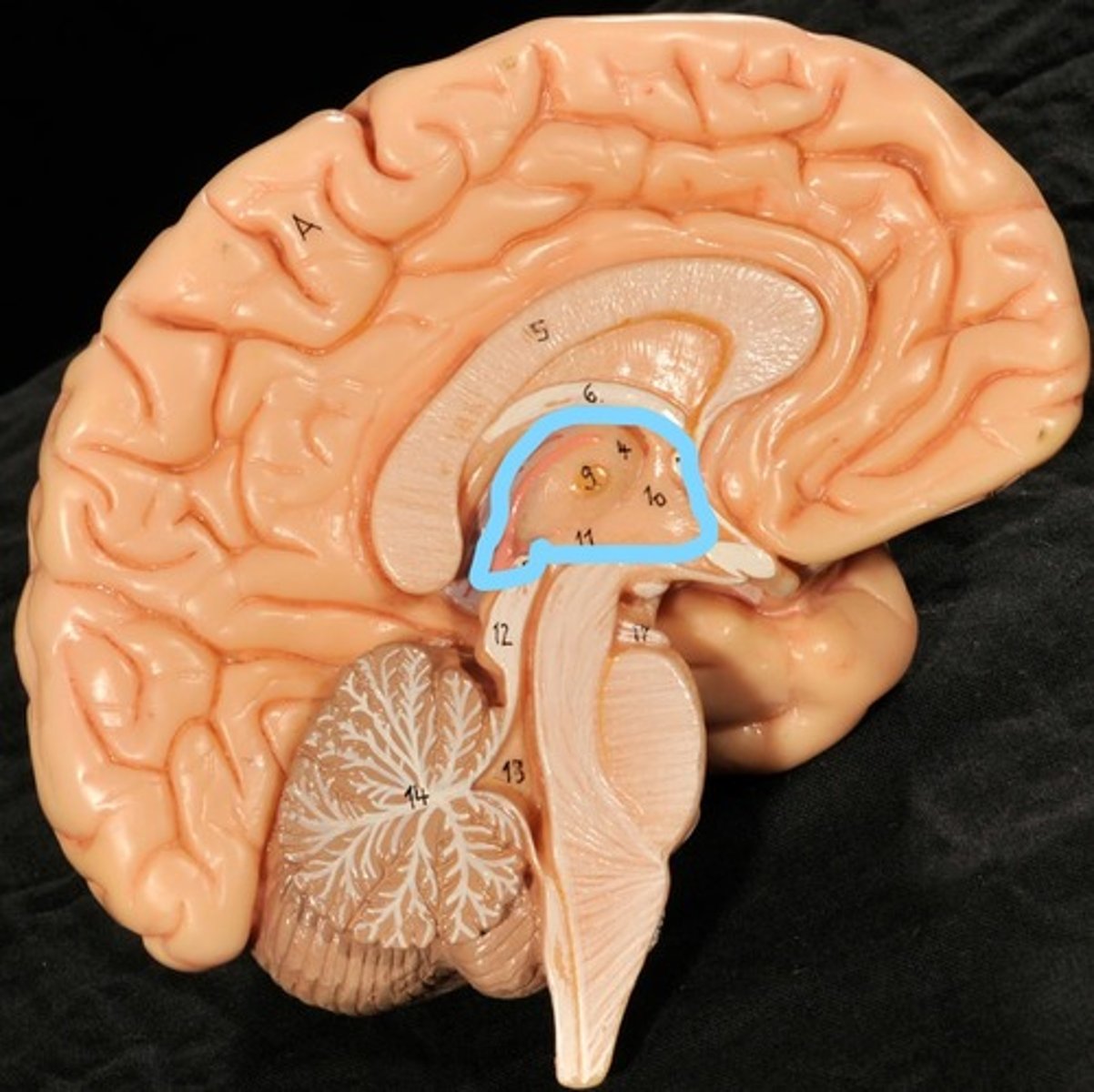 <p>thalamus, third ventricle, hypothalamus, epithalamus</p>