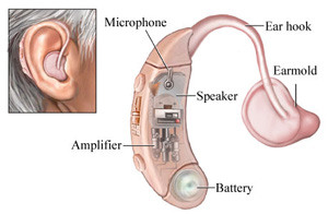 - amplify sound
- newer, digital aids are programmable
- adaptable to individual's needs (e.g, particular frequencies in need of boost)
- effective for those with cochlear function