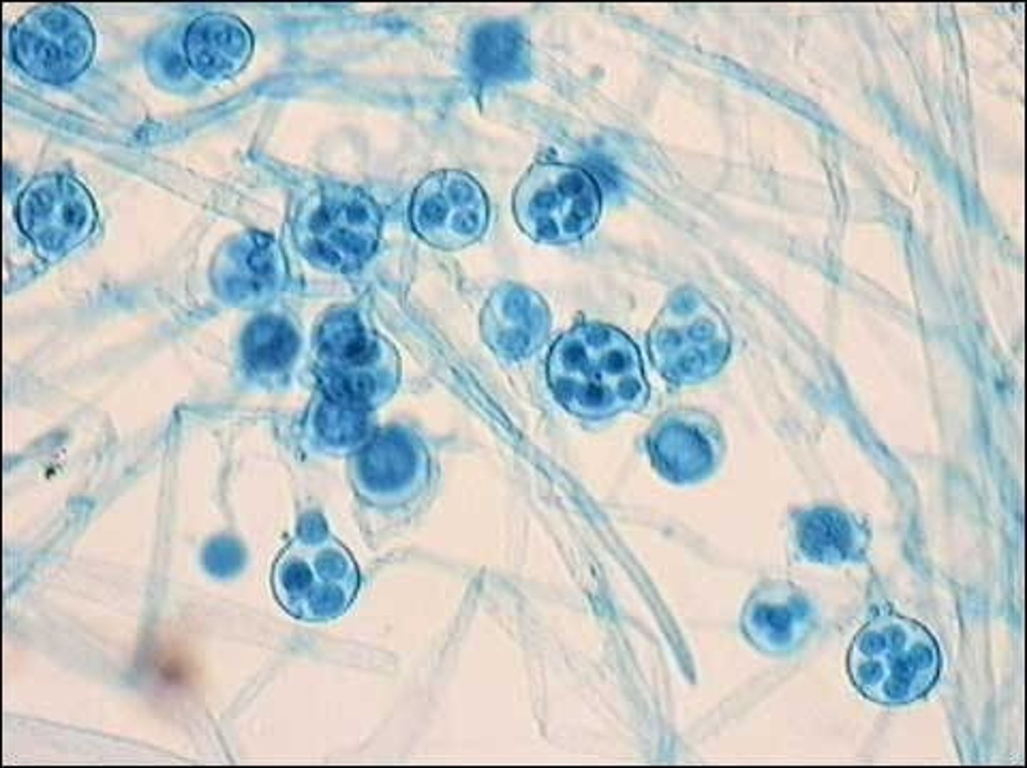 <p>- water mold </p><p>- either parasites or saprobes </p><p>- were once fungi </p><p>- found in water or on land</p><p>- phytophthora infestans (irish potato famine, 400,000 people died) </p>