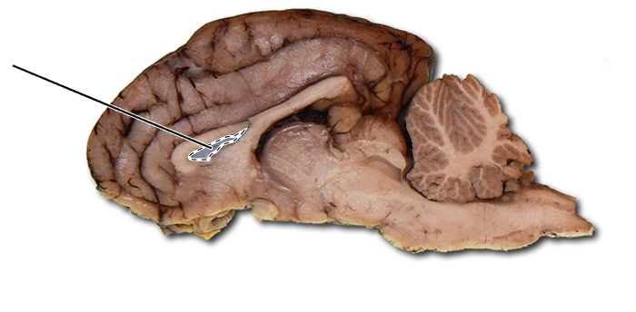 <p>Name the highlighted part of the brain.</p>