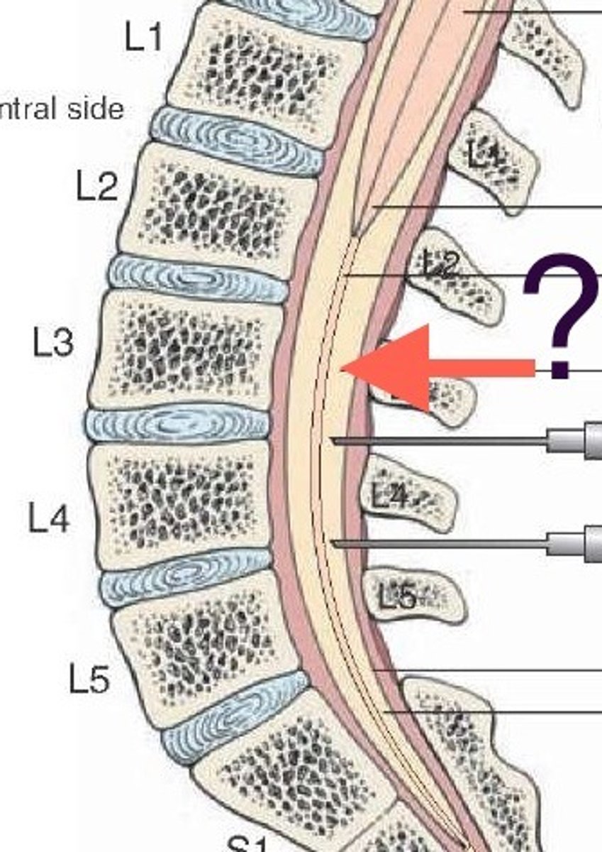 <p>subarachnoid space inferior to medullary cone that contains cauda equina and CSF</p>