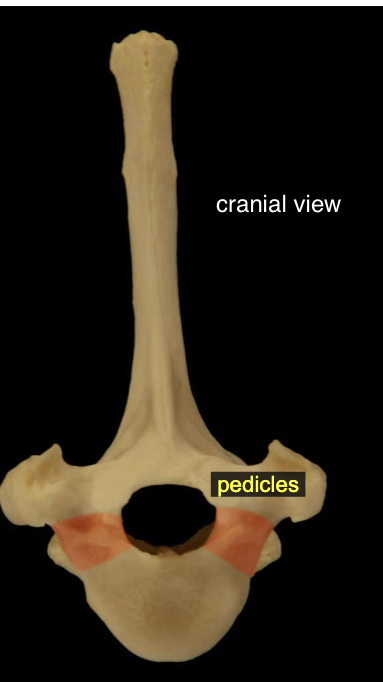 <p>The flattened, dorsal part of the arch consists of right and left laminae; these are attached via pedicles to the body.</p>