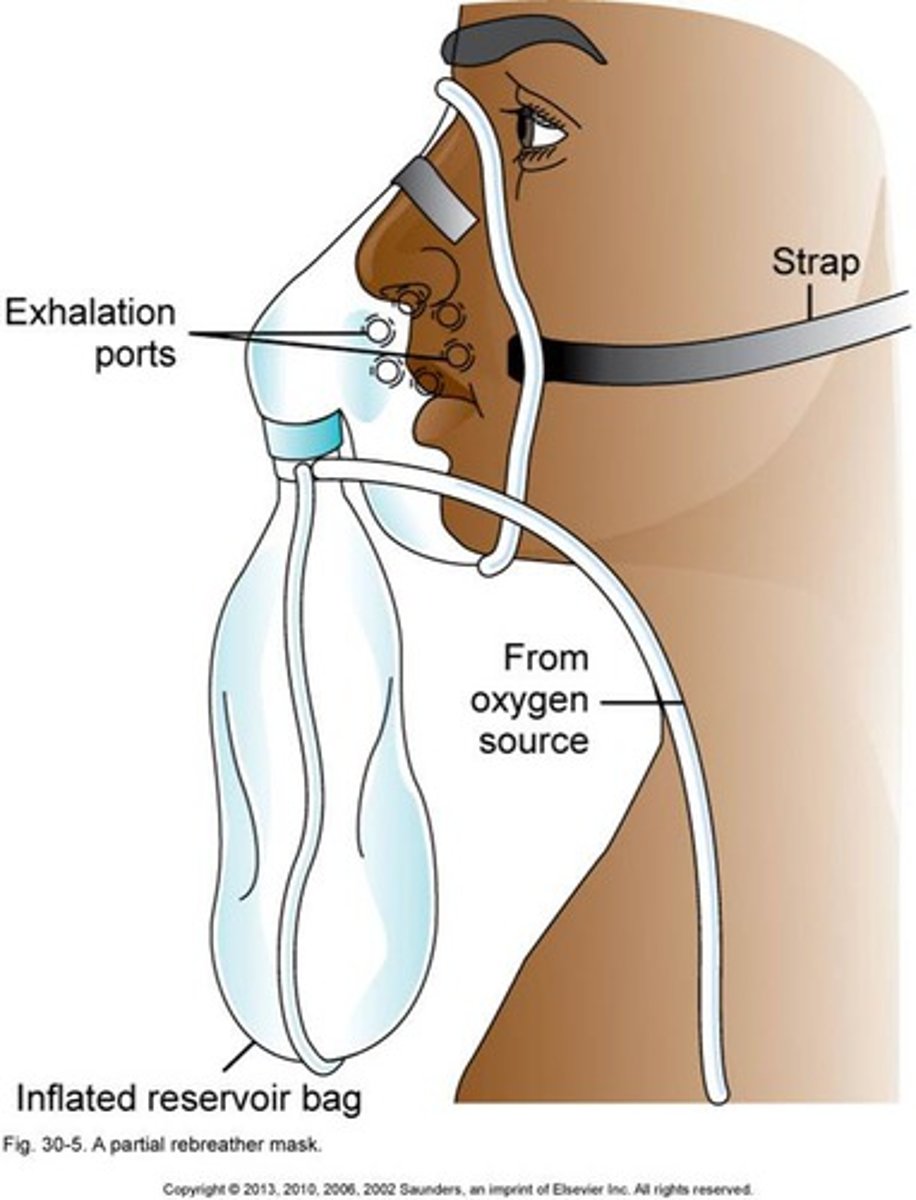 <p>allows higher levels of oxygen to be added to the air taken in by the patient</p><p>60-80% oxygen</p><p>10-15 L/min</p>