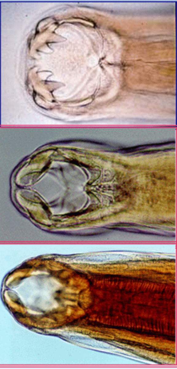 <p>which nematodes are known as "hookworms"?</p>