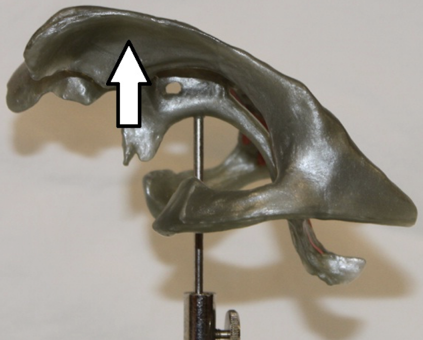<p>identify this structure/cavity</p>