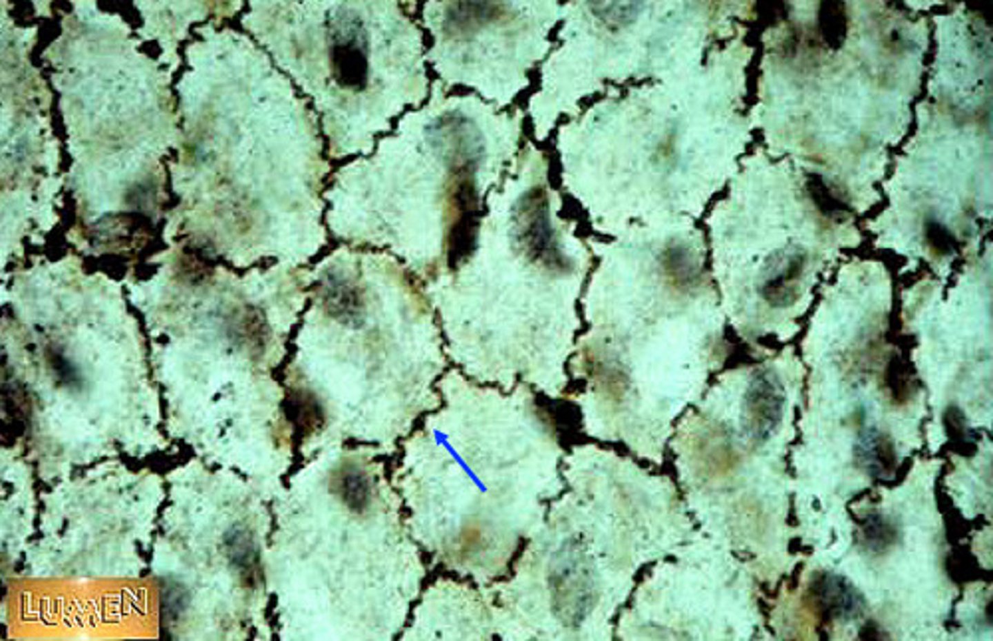 <p>Single layer of flat and irregular cells</p><p>Barely any matrix between cells</p><p>Locations: alveoli, lining heart and blood vessels, surface layer o pleura, pericardium, peritoneum, and organs, glomerular capsule</p><p>Functions: covering organs, diffusion (quick passage of CO2 or O2), smooth lining of vessels etc., secretion of serous fluid, reduction of friction</p><p>Myocardium - simple squamous separate blood and myocardium</p>