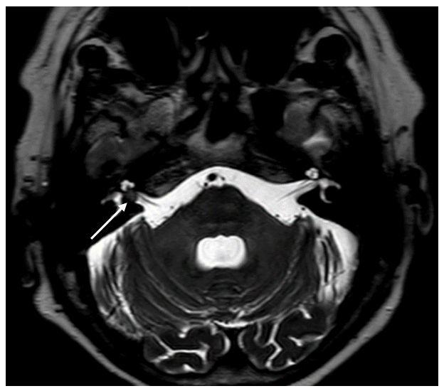 <p>What does this MRI image show, and what phase?</p>