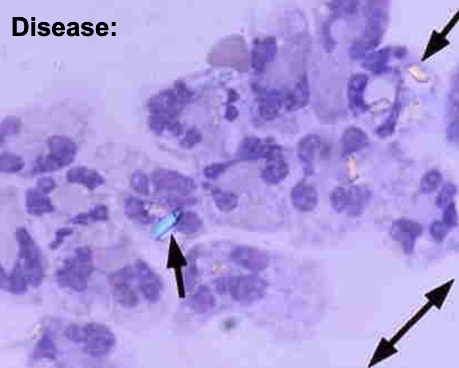 <p>What disease and how can you tell?</p>